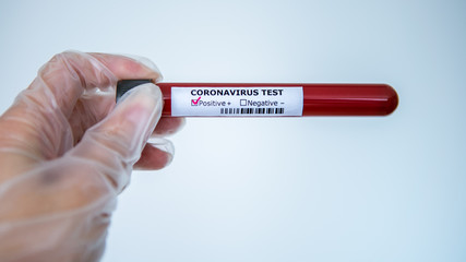 Surgical gloves with a positive coronavirus infected blood sample test.