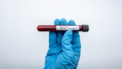 Negative COVID-19 test and laboratory sample blood testing for diagnosis