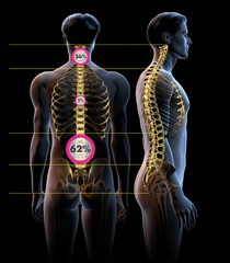 Backache pain, spine in back view and side view, 3D medically illustration