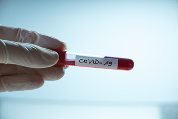 Doctor holding Positive / Negative COVID-19 test and laboratory sample of blood testing for diagnosis new Corona virus infection. Epidemic virus Respiratory Syndrome. Hospital blue light background.