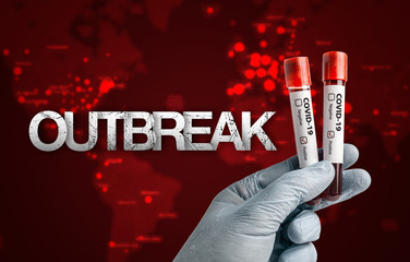 Pandemic COVID-19 concept: Scientist holding blood sample in test tubes with positive test result...
