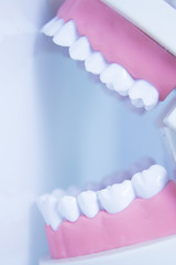 Model denture with metal orthodontics