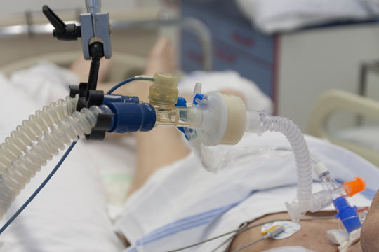 Respiratory connection tube, HME filter and suction catheter, patient connected to medical ventilator in ICU in hospital.