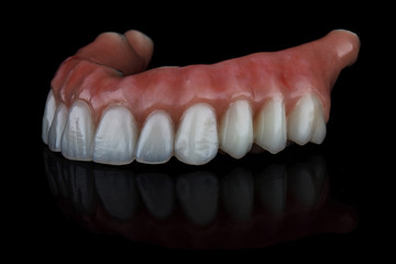 excellent dental prosthesis for the upper jaw on black glass with a beautiful reflection, side view