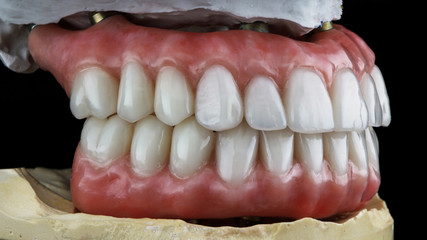 dental dentures for the lower and upper jaws on the dental model in the bite © Dental Pro Content