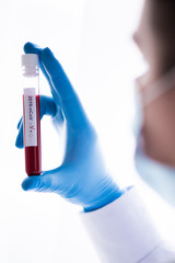 Test tube in male hand close up, doctor in medical mask holding vial with red liquid. Concept blood sample, coronavirus diagnostic, medical research
