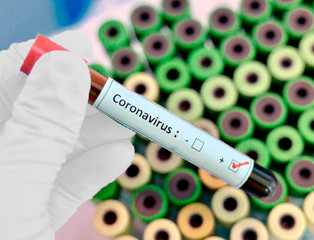 Obraz premium coronavirus in a flask in a hand
