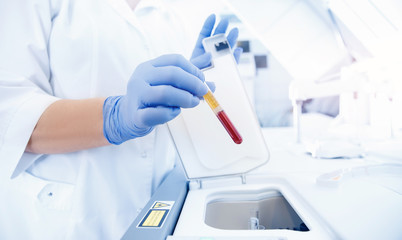 Medical worker in laboratory places blood sample for examination in automatic analyzer. Concept DNA...