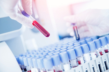 Lab worker preparing test blood for detection of antibodies and infections Corona virus