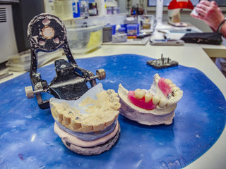 Dental gypsum articulator on table in laboratory