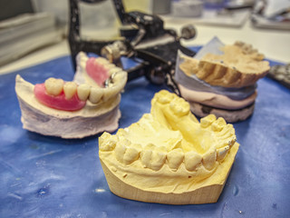 Ceramic dental implants on gypsum layout