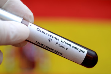 Obraz premium Stock photo of holding tube with Blood Test(novel Coronavirus 2019 disease,COVID-19,nCoV) and flag of Spain. Spain virus outbreak.