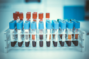 Coronavirus blood test concept. Analyzing blood sample in test tube for coronavirus test. Tube with blood for 2019-nCoV or COVID-19 test.