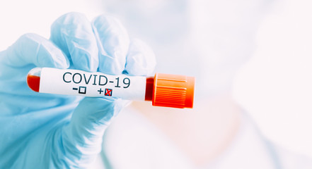 Scientist in protective gloves holding tube with positive blood test sample COVID-19.