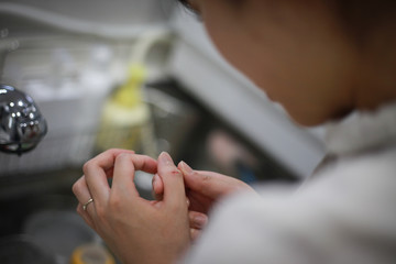 あかぎれに悩む女性