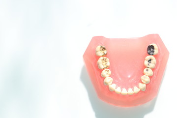 歯科模型 - obrazy, fototapety, plakaty