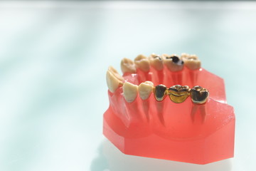 ブリッジ説明模型