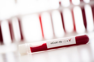 Test tube with blood sample for COVID-19 test, novel coronavirus 2019. Concept of vaccination,...