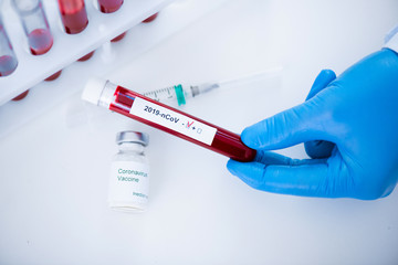 Close-up of test tube with a blood test and a coronavirus vaccine in hands of doctor. Concept of...