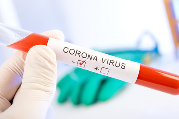 CORONA Virus