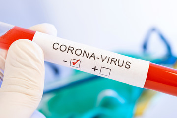 CORONA Virus