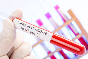 CORONA Virus