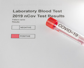 Laboratory results for nCov - 19 positive negative