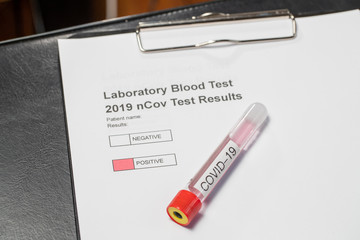 Laboratory results for nCov - 19 positive negative