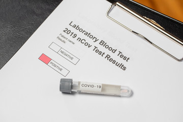 Laboratory results for nCov - 19 positive negative
