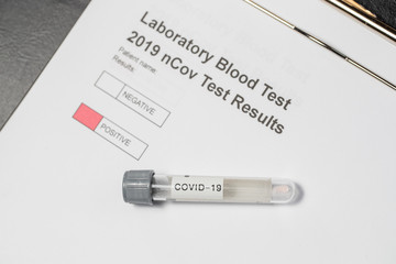 Obraz premium Laboratory results for nCov - 19 positive negative