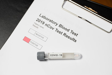 Laboratory results for nCov - 19 positive negative