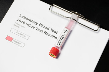 Laboratory results for nCov - 19 positive negative