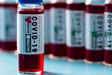 Virus disease lab covid-19 sample,  concept keep out.