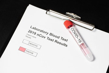 Laboratory results for nCov - 19 positive negative