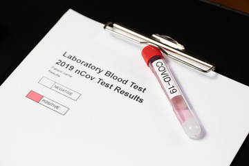 Laboratory results for nCov - 19 positive negative