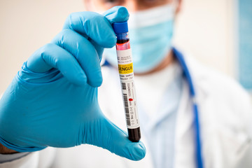 Doctor holding test tube blood sample