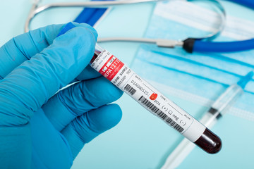 Blood samples with infected virus