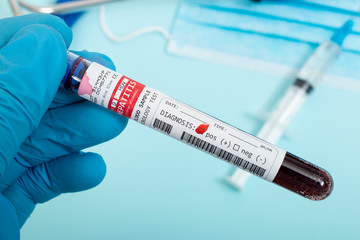 Naklejka premium Blood samples with infected virus