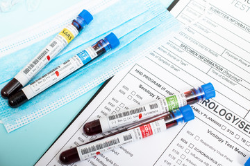 Several infected blood samples