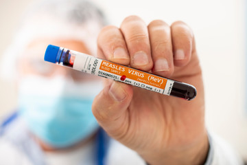 Fototapeta premium Doctor holding test tube blood sample