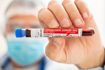 Fototapeta premium Doctor holding test tube blood sample