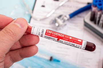 Obraz premium Blood samples with infected virus