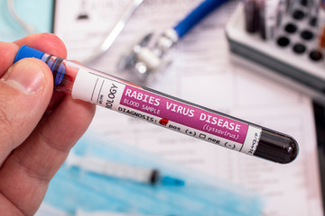 Obraz premium Blood samples with infected virus
