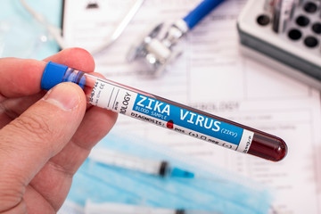 Fototapeta premium Blood samples with infected virus