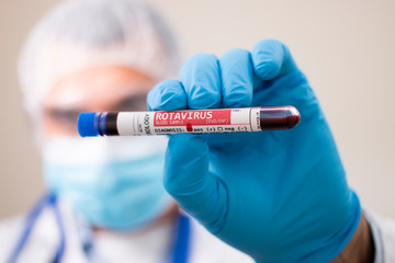 Doctor holding test tube blood sample