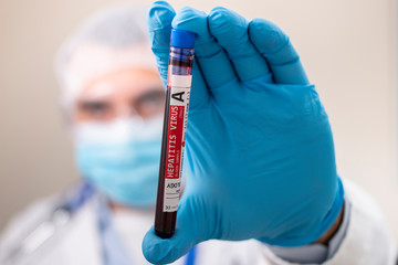 Doctor holding test tube blood sample