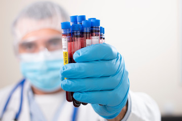 Doctor holding test tubes blood samples
