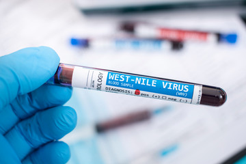 Blood samples with infected virus