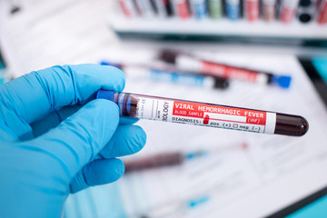 Fototapeta premium Blood samples with infected virus