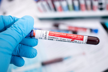Fototapeta premium Blood samples with infected virus